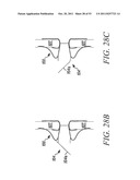 DEVICES AND METHODS FOR CORONARY SINUS PRESSURE RELIEF diagram and image