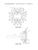 DEVICES AND METHODS FOR CORONARY SINUS PRESSURE RELIEF diagram and image