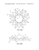 DEVICES AND METHODS FOR CORONARY SINUS PRESSURE RELIEF diagram and image