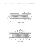 DEVICES AND METHODS FOR CORONARY SINUS PRESSURE RELIEF diagram and image