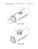 DEVICES AND METHODS FOR CORONARY SINUS PRESSURE RELIEF diagram and image