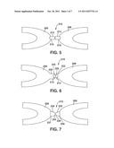 Flexible Stent Device with Magnetic Connections diagram and image