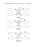 Flexible Stent Device with Magnetic Connections diagram and image