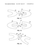 Flexible Stent Device with Magnetic Connections diagram and image