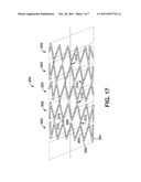 Flexible Stent Device with Magnetic Connections diagram and image