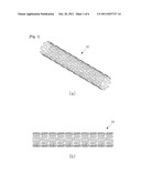 Expanding Vascular Stent diagram and image