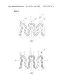 Expanding Vascular Stent diagram and image