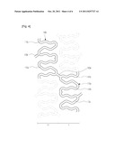 Expanding Vascular Stent diagram and image