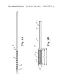 Transcatheter Prosthetic Heart Valve Delivery System and Method with     Expandable Stability Tube diagram and image