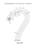 Transcatheter Prosthetic Heart Valve Delivery System and Method with     Expandable Stability Tube diagram and image