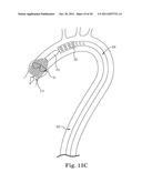 Transcatheter Prosthetic Heart Valve Delivery System and Method with     Expandable Stability Tube diagram and image