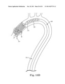 Transcatheter Prosthetic Heart Valve Delivery System and Method with     Expandable Stability Tube diagram and image