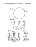 Flexible Heart Valve and Holder Therefor diagram and image