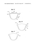 Flexible Heart Valve and Holder Therefor diagram and image