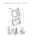 Flexible Heart Valve and Holder Therefor diagram and image