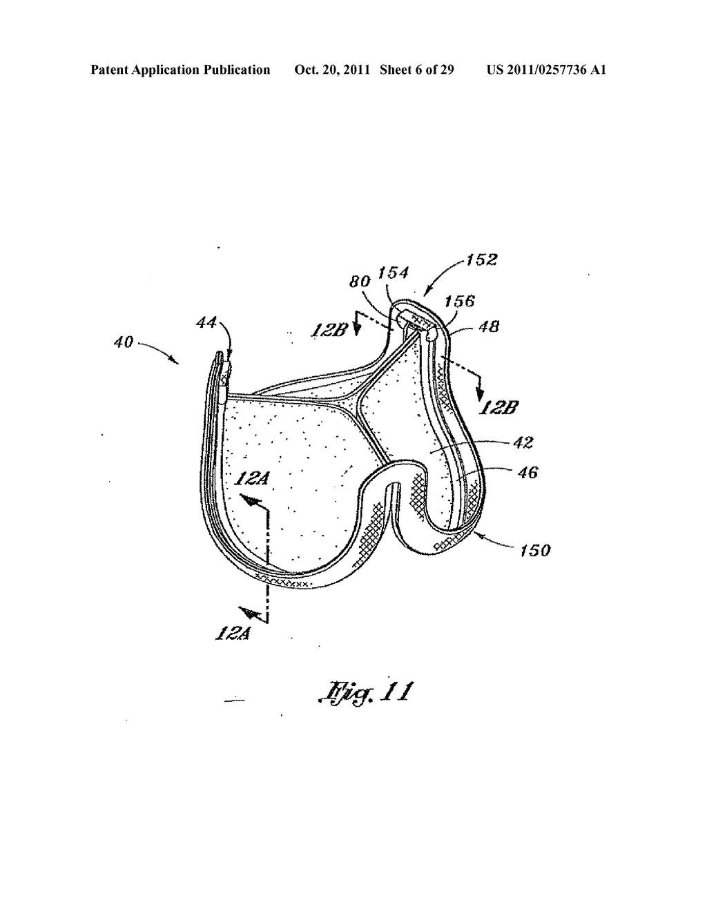 Flexible Heart Valve and Holder Therefor - diagram, schematic, and image 07