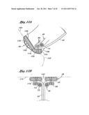 Flexible Heart Valve and Holder Therefor diagram and image