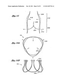 Flexible Heart Valve and Holder Therefor diagram and image