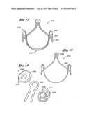 Flexible Heart Valve and Holder Therefor diagram and image