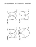 Flexible Heart Valve and Holder Therefor diagram and image