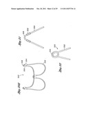 Flexible Heart Valve and Holder Therefor diagram and image