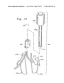 Flexible Heart Valve and Holder Therefor diagram and image