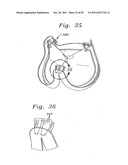 Flexible Heart Valve and Holder Therefor diagram and image