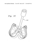 Flexible Heart Valve and Holder Therefor diagram and image