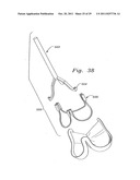 Flexible Heart Valve and Holder Therefor diagram and image