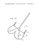 Flexible Heart Valve and Holder Therefor diagram and image