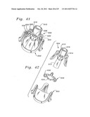 Flexible Heart Valve and Holder Therefor diagram and image