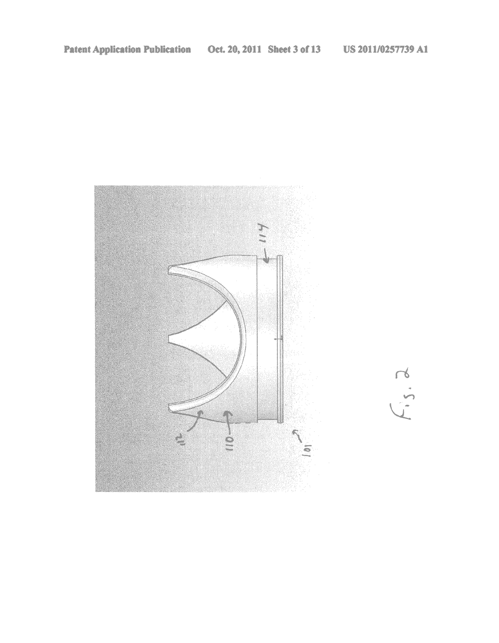 PERCUTANEOUS VALVE DEPLOYMENT - diagram, schematic, and image 04