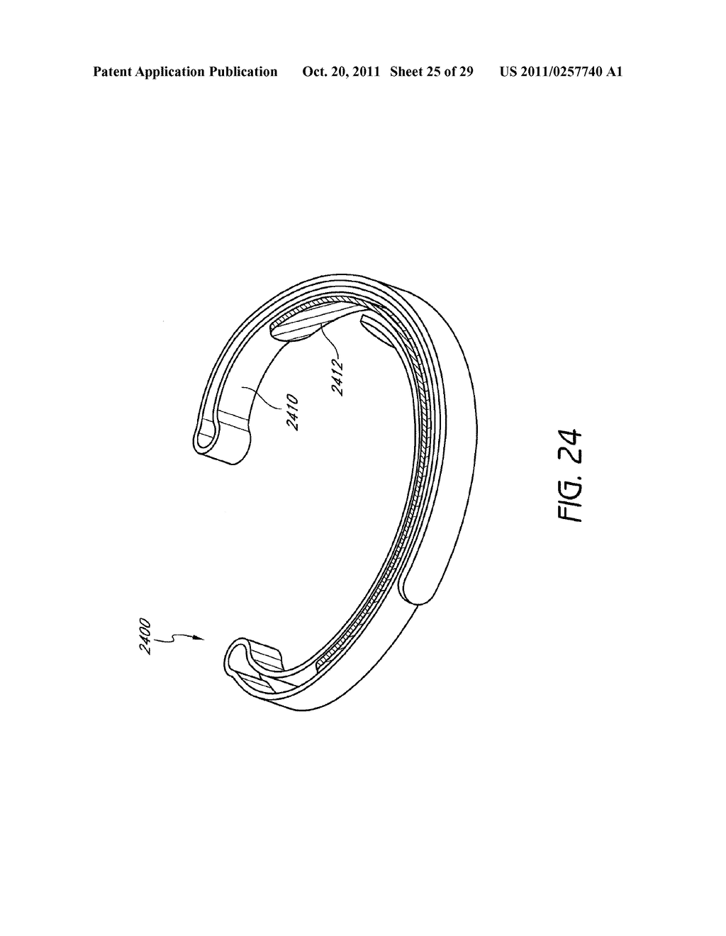 SELECTIVELY ADJUSTABLE CARDIAC VALVE IMPLANTS - diagram, schematic, and image 26