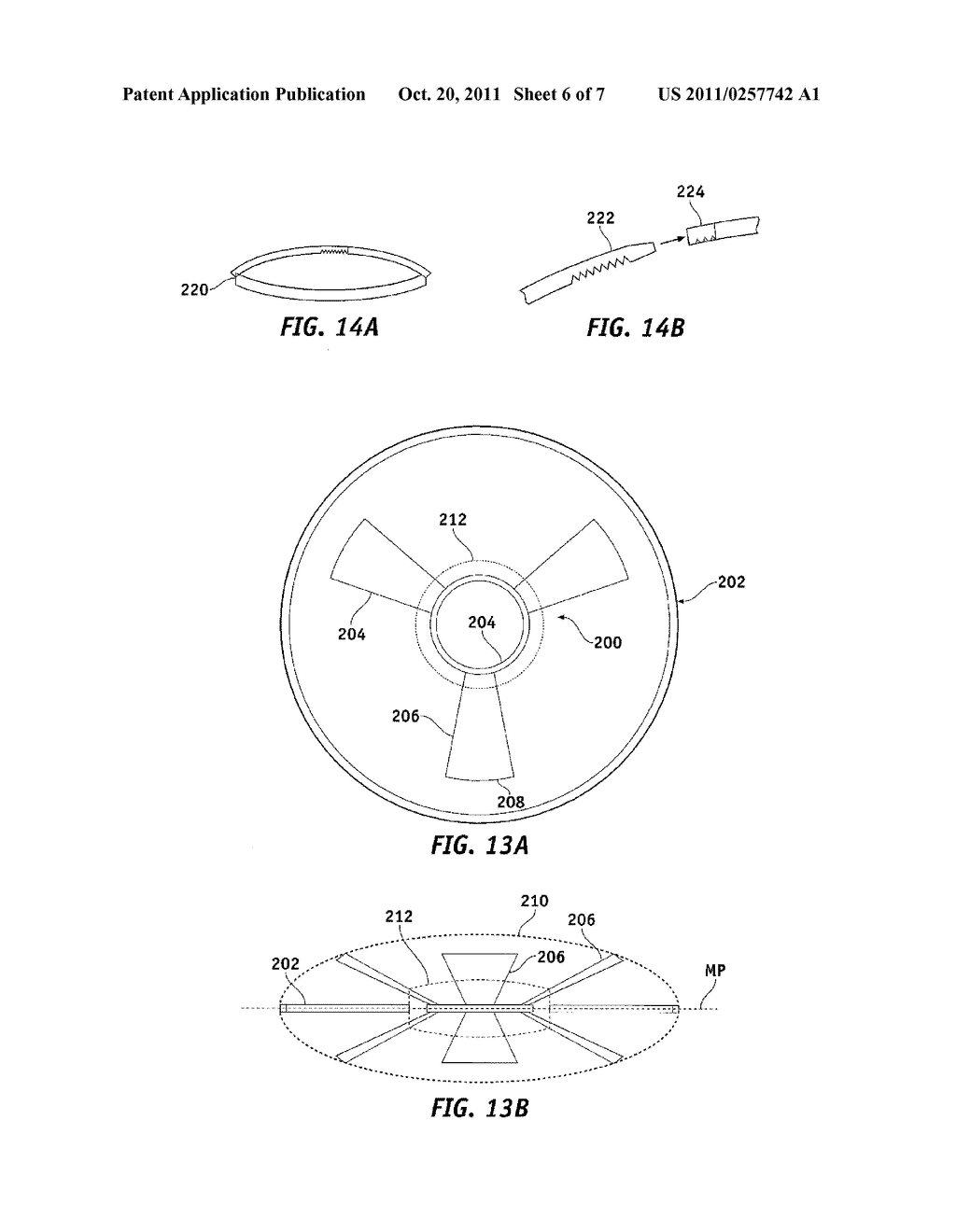 ACCOMMODATING INTRAOCULAR LENSES - diagram, schematic, and image 07