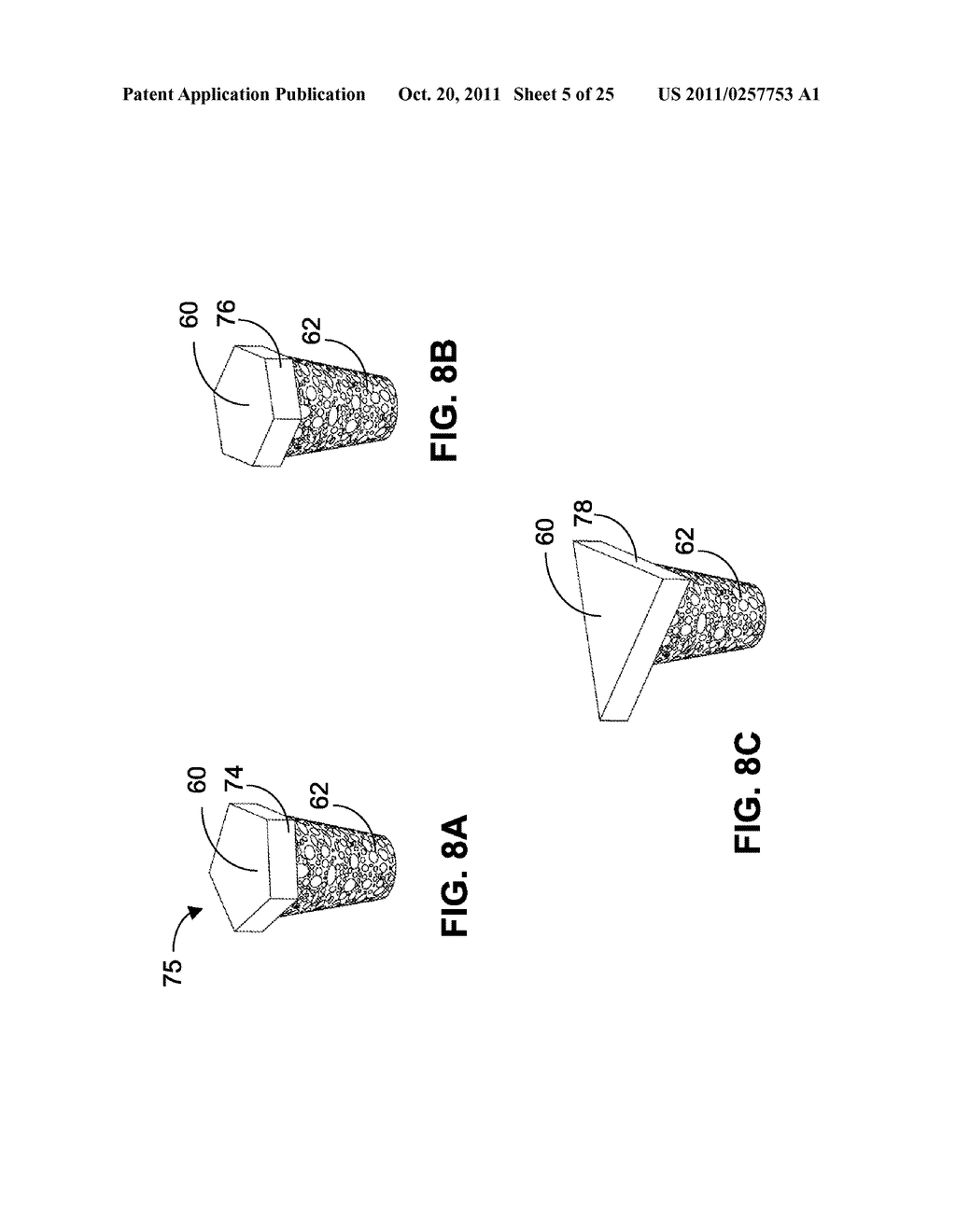 IMPLANT HAVING A CONVEX SURFACE SURROUNDING A CONCAVE ARTICULAR SURFACE - diagram, schematic, and image 06