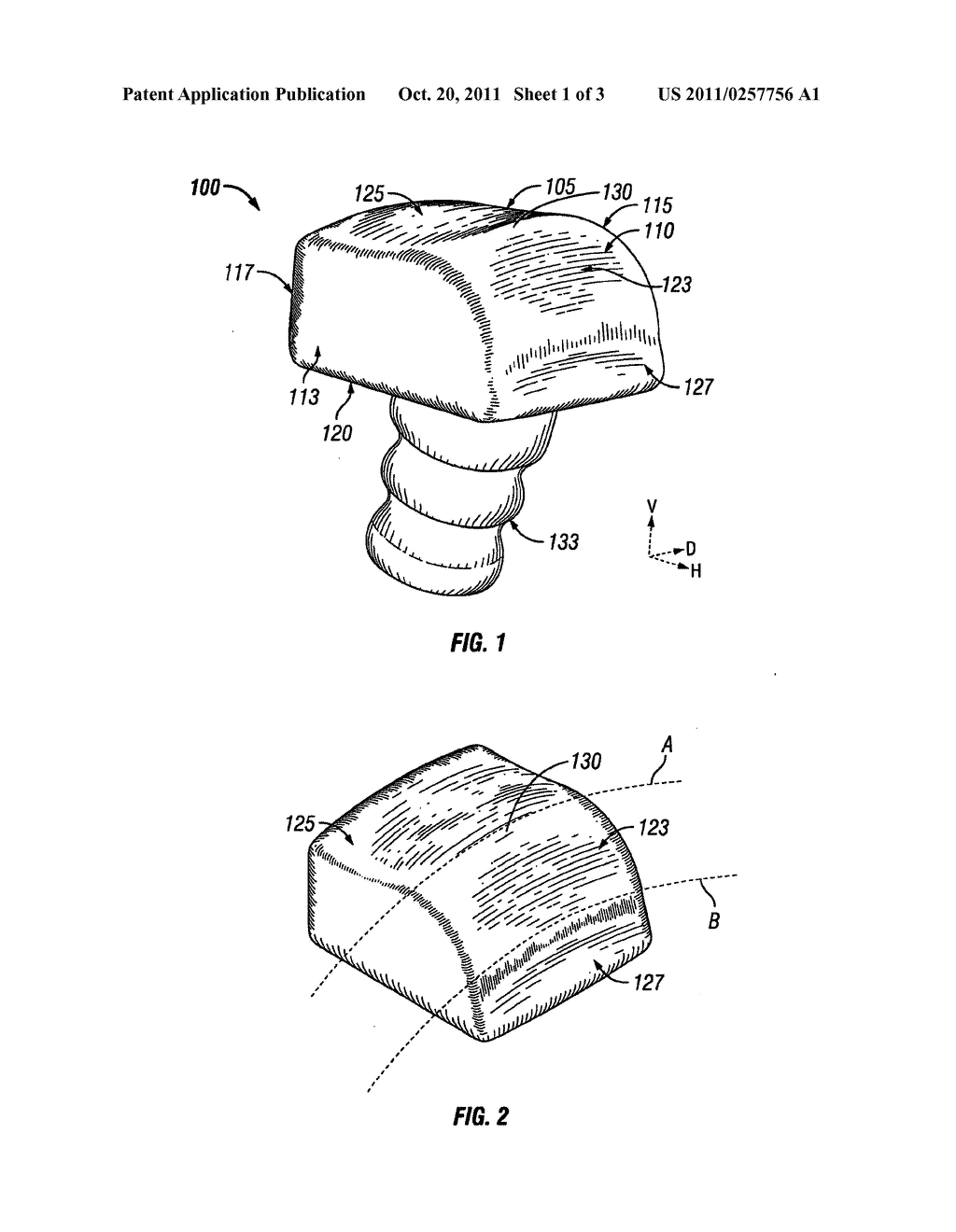 TALAR IMPLANTS AND METHODS OF USE - diagram, schematic, and image 02