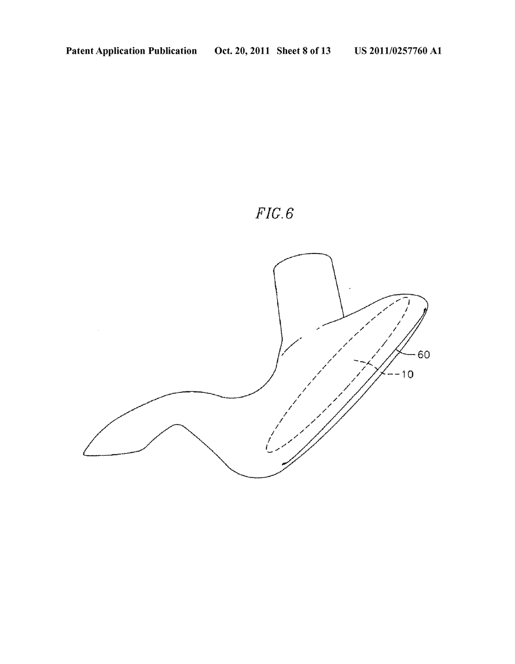 GASTRIC IMPLANT AND METHOD FOR USE OF SAME - diagram, schematic, and image 09