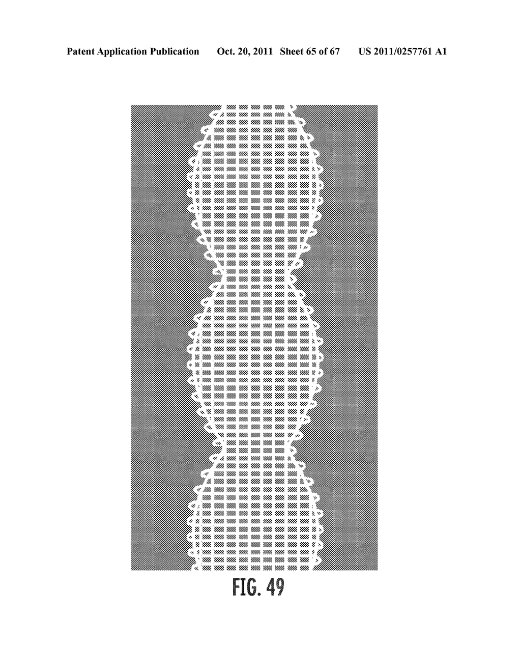 PROSTHETIC DEVICE HAVING REGIONS OF VARYING STRETCH AND METHOD OF     MANUFACTURING THE SAME - diagram, schematic, and image 66