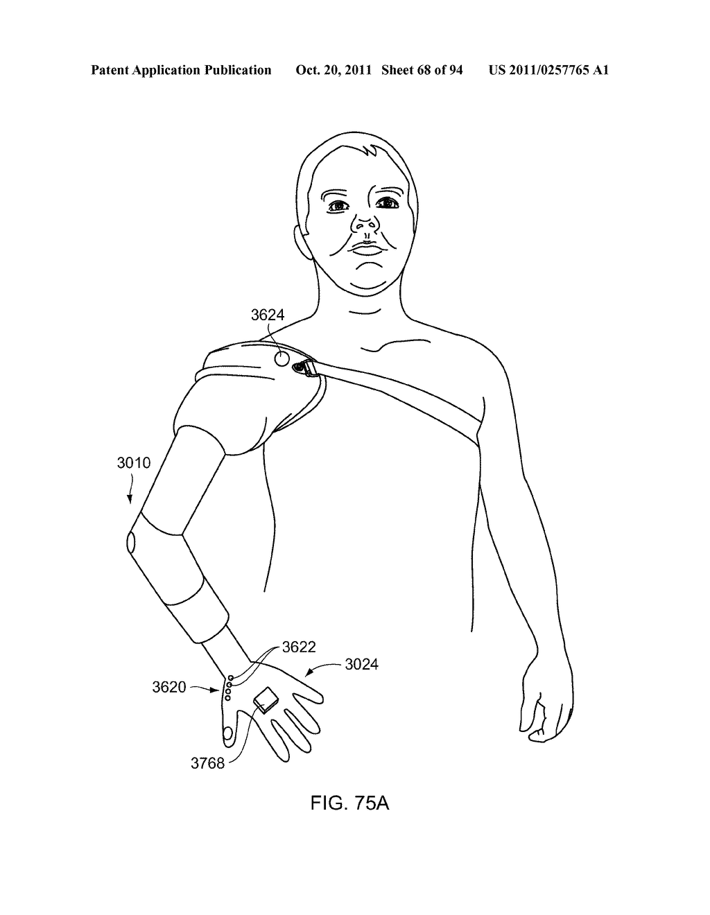 ARM PROSTHETIC DEVICE - diagram, schematic, and image 69