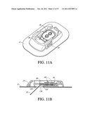 TRANSCUTANEOUS ANALYTE SENSOR diagram and image