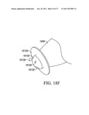 TRANSCUTANEOUS ANALYTE SENSOR diagram and image