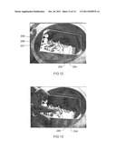 METHOD FOR PREPARING A PATIENT FOR A MEDICAL TREATMENT diagram and image