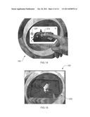 METHOD FOR PREPARING A PATIENT FOR A MEDICAL TREATMENT diagram and image