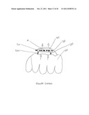 PRESSURE ACTIVATED LIGHTED GLOVE diagram and image