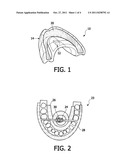 SYSTEM FOR AXIAL BRISTLE MOTION IN A TEETH CLEANING MOUTHPIECE diagram and image