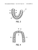 SYSTEM FOR AXIAL BRISTLE MOTION IN A TEETH CLEANING MOUTHPIECE diagram and image