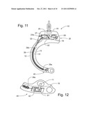 Remote Lock Mechanism for Handcuffs and Other Security Devices diagram and image