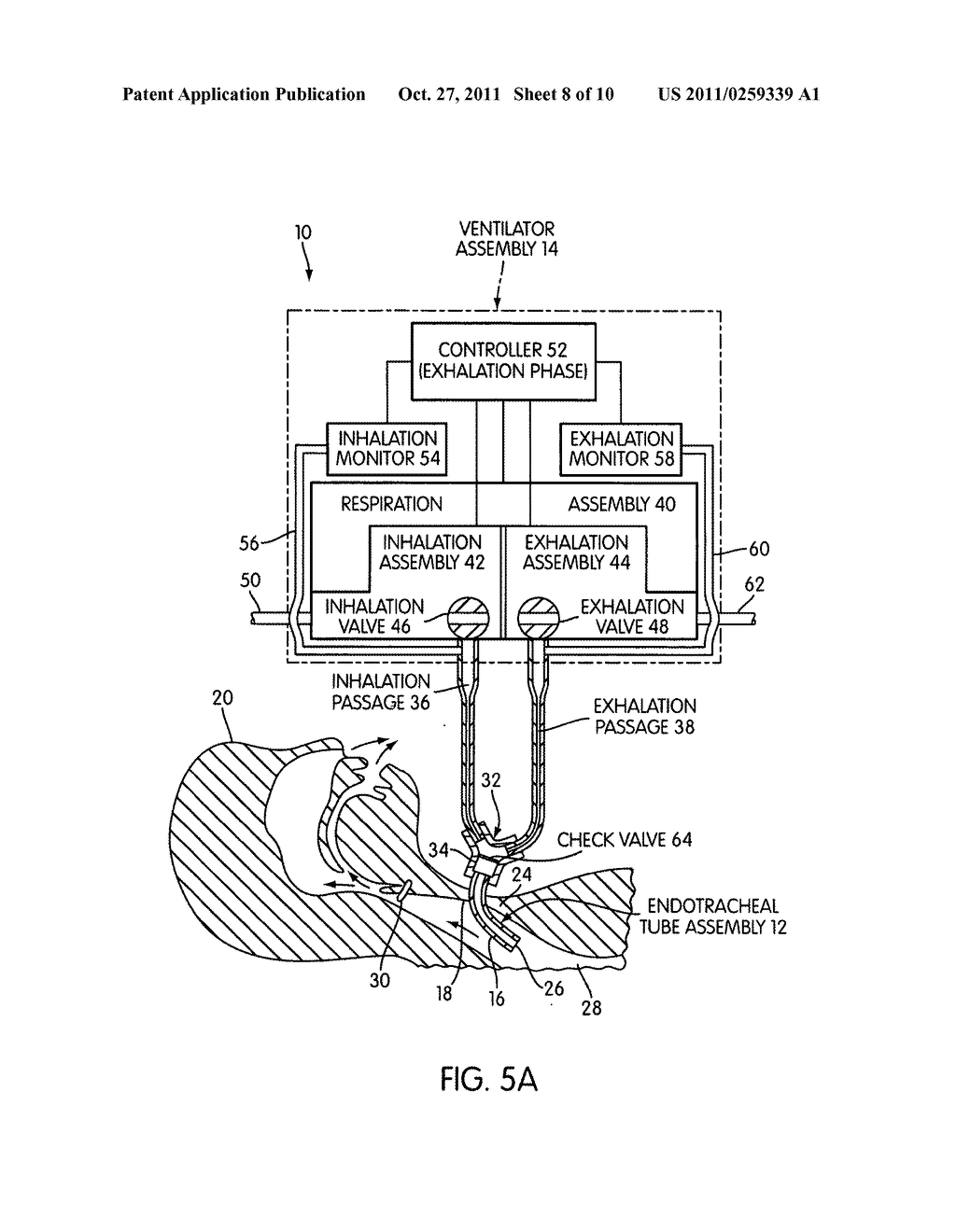 VENTILATING APPARATUS AND METHOD ENABLING A PATIENT TO TALK WITH OR     WITHOUT A TRACHOSTOMY TUBE CHECK VALVE - diagram, schematic, and image 09