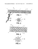 METHODS AND APPARATUS FOR OCCLUDING REPRODUCTIVE TRACTS TO EFFECT     CONTRACEPTION diagram and image