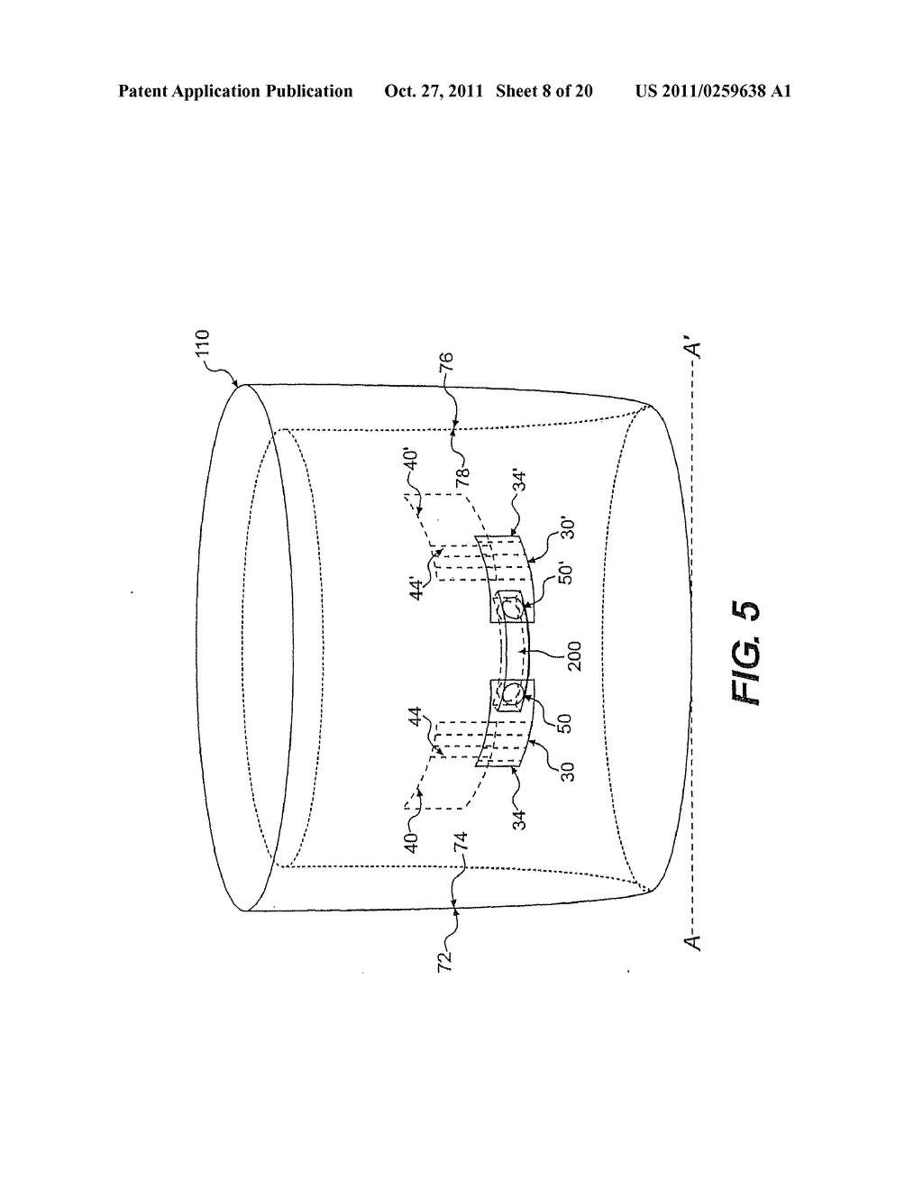 TEXTILE-BASED ELECTRODES INCORPORATING GRADUATED PATTERNS - diagram, schematic, and image 09